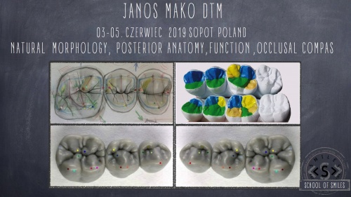 Janos Mako - Occlusal Compas