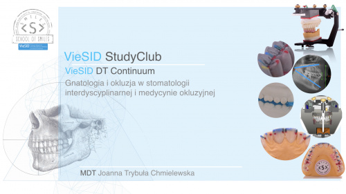 VieSID Study Club - DT Continuum